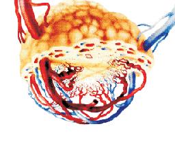 Id-2 protein expression and microvessel density assessment in various types of malignant ovarian tumors 39 suggest that up-regulation of Id1 and Id2 proteins is often observed in ovarian cancer and