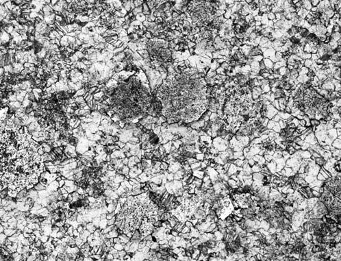 Fig. 7. Zdolomityzowane kalkarenity: A czêœciowo zdolomityzowany kalkarenit (anizyk, Giewont, jednostka wierchowa). Zg³ad; B oopelsparyt.