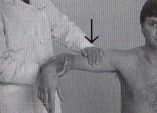 Inferior instability Arm abducted 90 deg