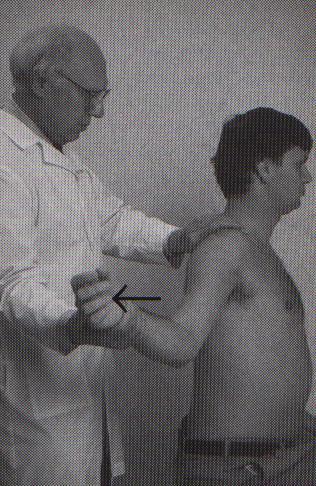 Apprehension sign Throwing position Pull into ext rotation and