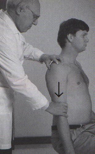 Sulcus sign Arm at side Pull inferiorly Deepening