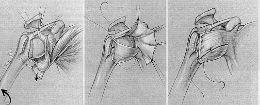 Multidirectional Instability