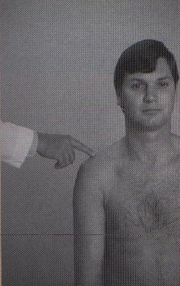 Acromioclavicular joint Palpate posterior