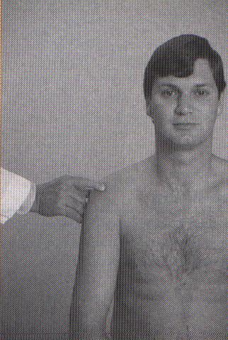 Subacromial bursa Palpate from antero- lateral acromion