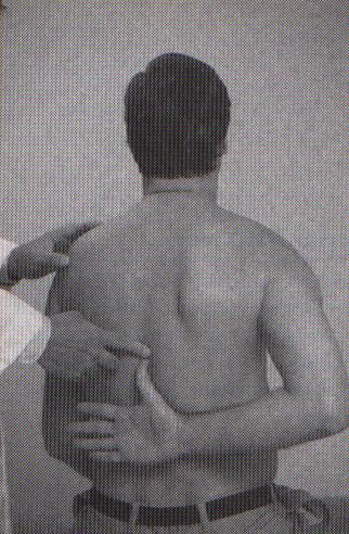 Internal shoulder rotation Patient seated Place