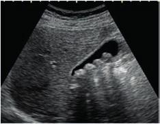 Zadanie 36. Kiedy w procesie terapii wykonuje się badanie CBCT (cone beam computed tomography)? A. Przed rozpoczęciem leczenia. B. Po ukończeniu leczenia. C. Przy końcu leczenia. D. W środku leczenia.