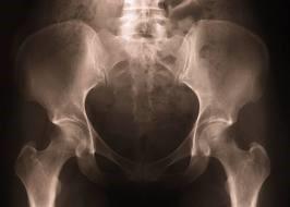 Jama brzuszna (cavum abdominis) jest ograniczona od góry przeponą, od dołu talerzami kości biodrowych, składa się z jamy otrzewnej i przestrzeni