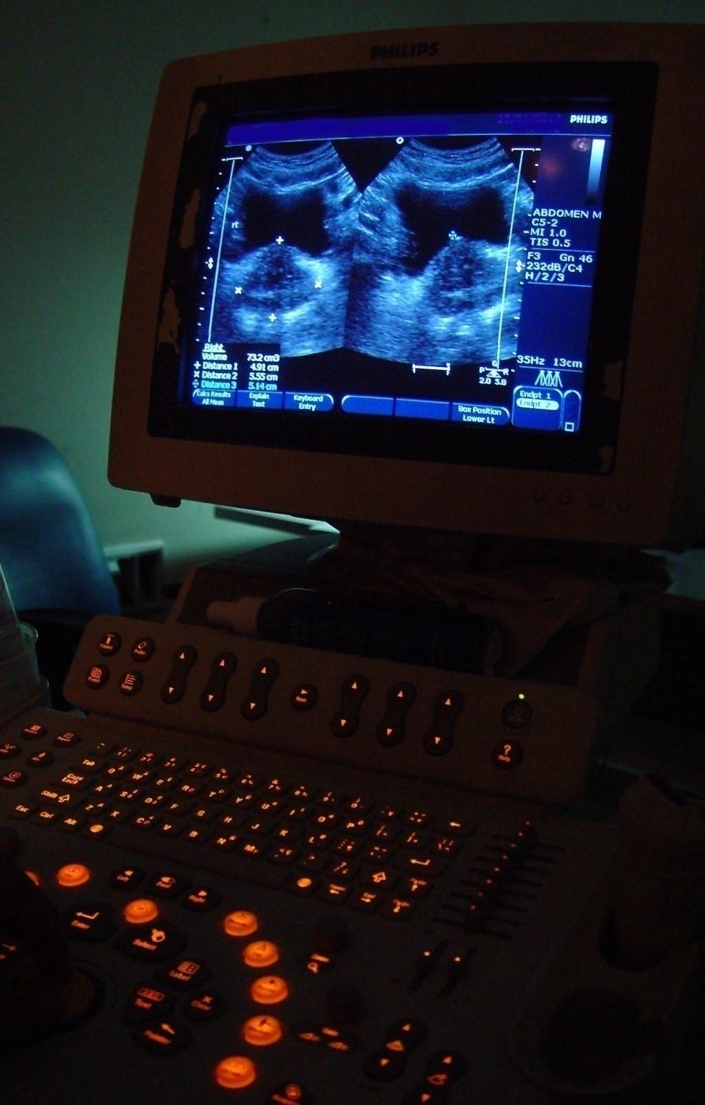 Ultrasonografia, USG nieinwazyjna, metoda diagnostyczna, pozwalająca na uzyskanie obrazu przekroju badanego narządu.