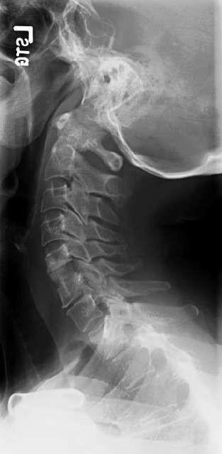 MRI RTG