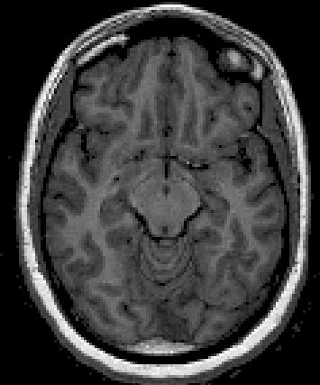 ~2mm 2 FMRI Week 1