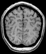 resolution e.