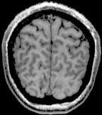 64 = 3 mm