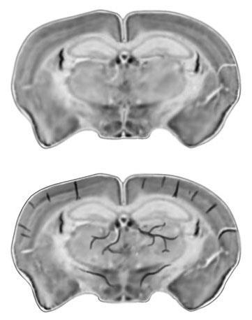 Imaging obecność deoxyhb w