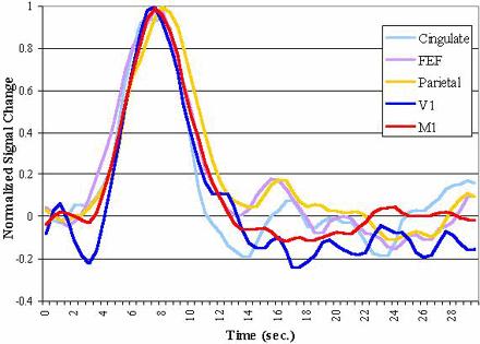 Schemat wywołanego lub zdarzeniowego fmri (event-related fmri) zalety: ocenia się