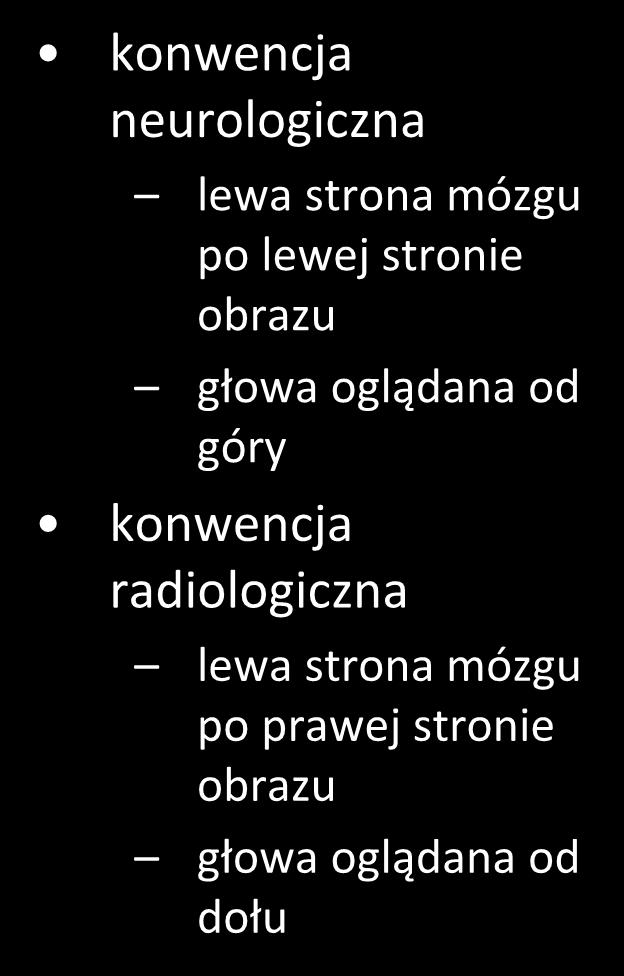 konwencje wyświetlania obrazów konwencja neurologiczna lewa strona mózgu po