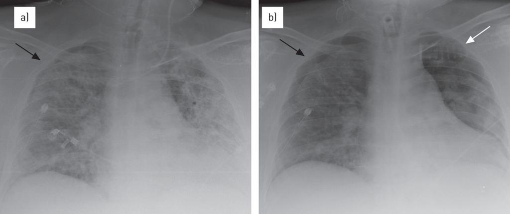 http://err.ersjournals.