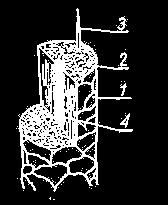 34. Poniższy rysunek przedstawia przekrój łodygi włosa.