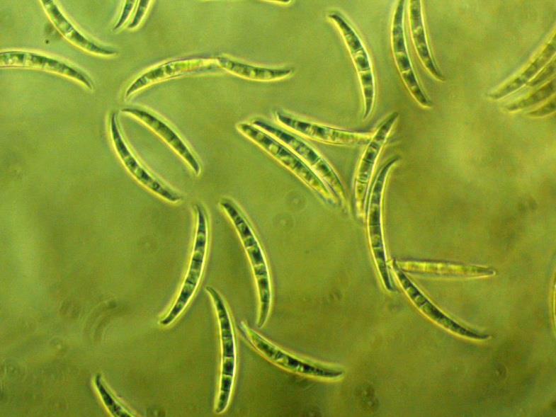 4 Analiza składu gatunkowego grzybów z rodzaju Fusarium powodujących fuzariozę kłosów pszenicy oraz skażenia ziarna toksynami w powiązaniu z warunkami