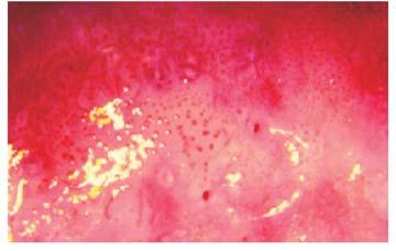 It is an area of white fields separated with red lines ( honeycomb ), situated within the regenerating