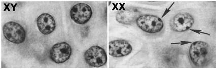 Inaktywacja chromosomu X: wyciszanie epigenetyczne Mus musculus: u samic od wczesnego etapu rozwoju zarodkowego na aktywnym chromosomie X ekspresja Tsix, na nieaktywnym ekspresja Xist i RepA John E.