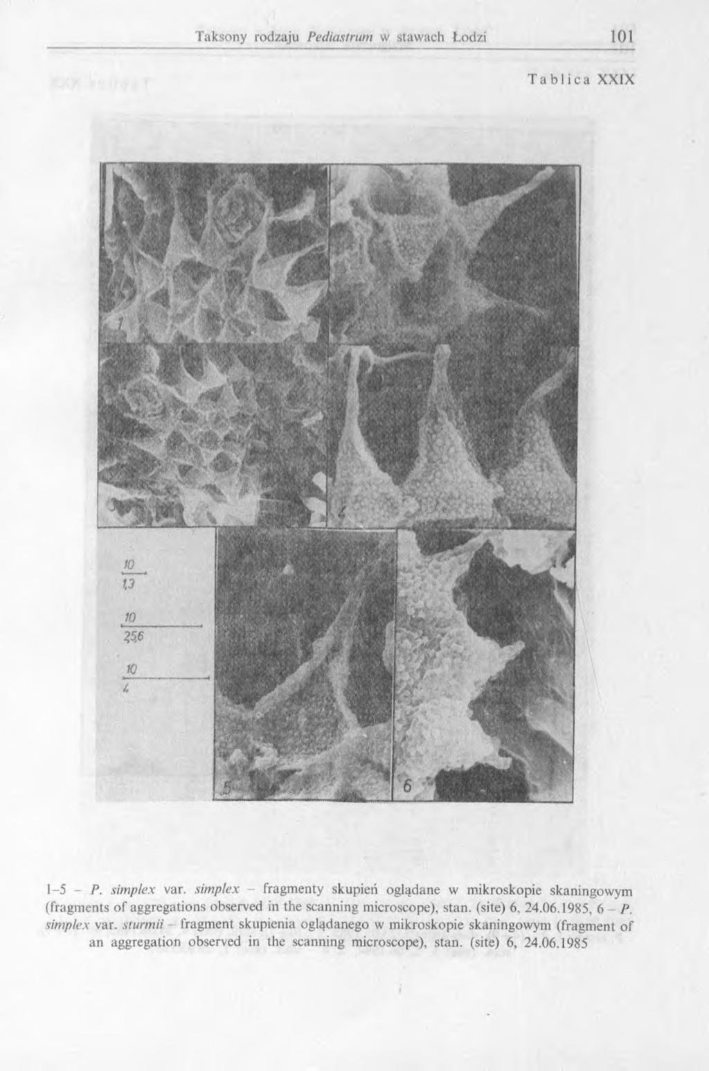 Tablica XXIX 1-5 - P. simplex var. simplex - fragmenty skupień oglądane w mikroskopie skaningowym (fragments of aggregations observed in the scanning microscope), stan. (site) 6, 24.