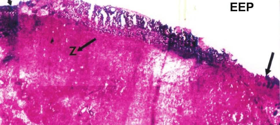 RNA w tkankach rany oparzeniowej Grupy zwierząt po 21-dniowym eksperymencie kontrolna leczona 3% EEP (maść) Dehydrogenaza glukozo-6- -fosforanowa nabłonek 85,9 102,6 włókna mięśniowe 81,4 103,7 Ryc.