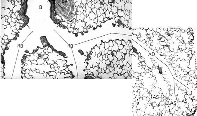 maczugowatymi Oskrzeliki oddechowe przewody pęcherzykowe