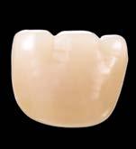 Zęby konfekcyjne VITA MFT do protez wykonane z polimeru HC przeznaczone są