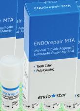 ENDOSTAR ENDOREPAIR MTA CEMENT NAPRAWCZY > Do pokrywania miazgi oraz wype³niania wierzcho³ków