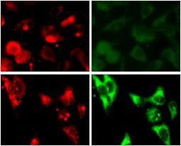 Dostarczanie do komórek koniugaty dodekahedron - kap anti-dd Immunodetection anti-cap Dd Dd-cap % Control 160 140 120 100 80 60 40 20 0 Tumor size