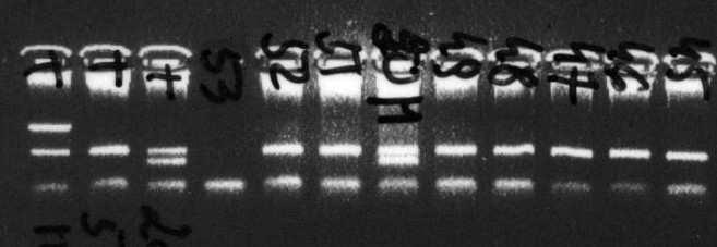 BRCA1 MULTIPLEX PCR controls patients