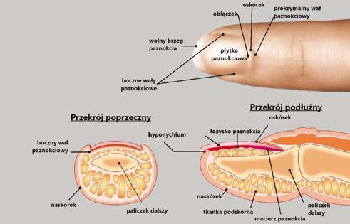 Tabela 1 Diagnostyka różnicowa podłużnej melanonychii Przyczyny zmian barwnikowych paznokci Łagodne znamię melanocytowe podpaznokciowe Czerniak podpaznokciowy Działanie niepożądane leków i