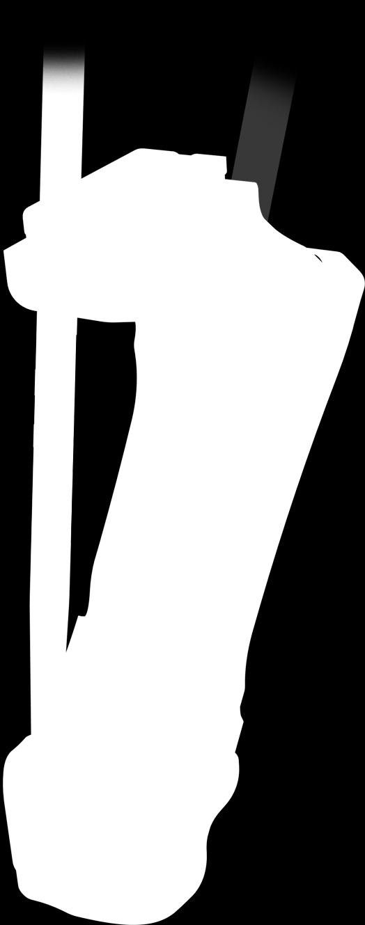 IV.3. REDUKCJA ZŁAMANIA Konieczne jest dokładne anatomiczne nastawienie