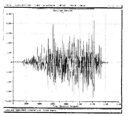 ELEKTROMIOGRAM charakteryzuje się : amplitudą (100µV- 5mV), która zależy od liczby