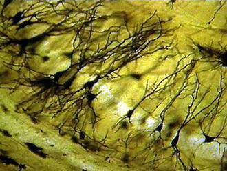 Wprowadzenie Neuron