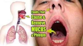 Mucus blgm 9 th