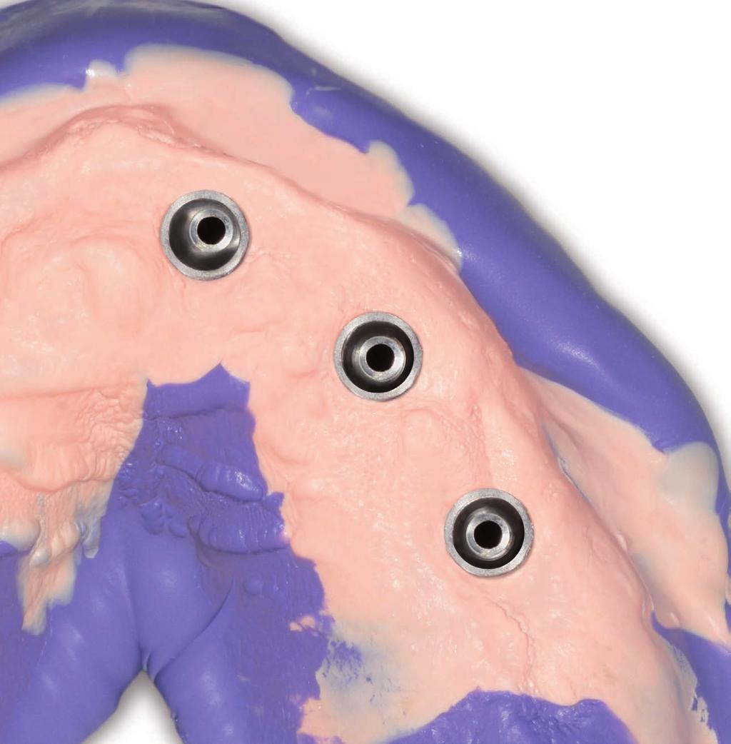hydrorise implant SIMPLY ACCURATE