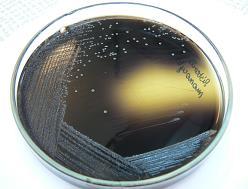 Rys. Kolonie Listeria monocytogenes na podłożu Oxford. Pożywka PALCAM-agar- pożywka wybiórczo-rożnicująca.