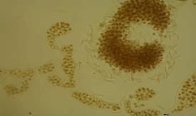 Biotesty LC-MS/MS O H 2 N H N NH 2 O H N O N H O O