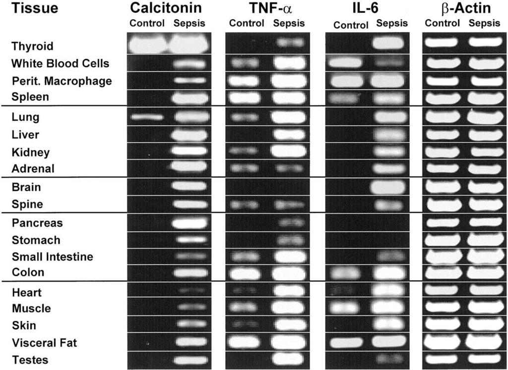 adapted from Müller B et al.