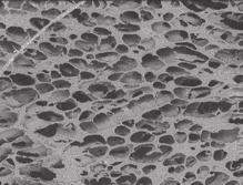 Wymiary porów mieściły się w przedziale 2 75 µm, a ich ściany, podobnie jak opisano poprzednio, były perforowane.