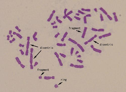 Analiza aberracji chromosomowych jako metoda