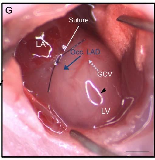 Na schemacie zaznaczono następujące struktury anatomiczne: lewy przedsionek (LA), lewą komorę (LV), żyłę wieńcową wielką (GCV), a także założony szew (Suture) oraz podwiązaną tętnicę przednią