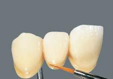 Nakładanie warstw wg schematu BASIC Masę BASE DENTINE nakładamy w obszarze szyjki i uzupełniamy cały kształt zęba. Obszar sieczny uzupełniamy masą ENAMEL.