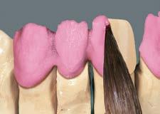 Proszek BASE DENTINE zostaje rozmieszany z płynem MODELLING FLUID RS do rzadkiej konsystencji, a następnie nałożony pędzelkiem na czystą podbudową, tworząc cienką,