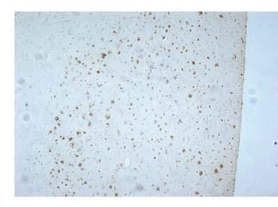 embryonic brain regions or at specific developmental epochs or in a specific subset of progenitor cell types?