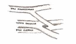 Wykazano korzyści z takiej operacji, jak minimalne ryzyko wystąpienia zespołu podkradania, niewydolności serca, zachowanie bardziej proksymalnych odcinków naczyń na przyszłość i prawie 50-procentową