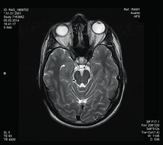 Mi1200 SYNCHRONY ABI Mi1200 SYNCHRONY PIN ABI Nieprzestrzeganie warunków bezpieczeństwa MRI i zaleceń oraz wskazówek dotyczących bezpieczeństwa skanowania MRI może spowodować uraz u pacjenta i/lub