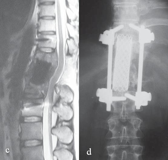 lata. Fig. 2.