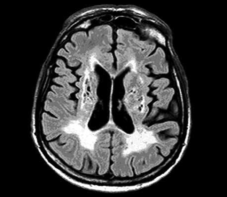 cular development and human vascular disease [23].